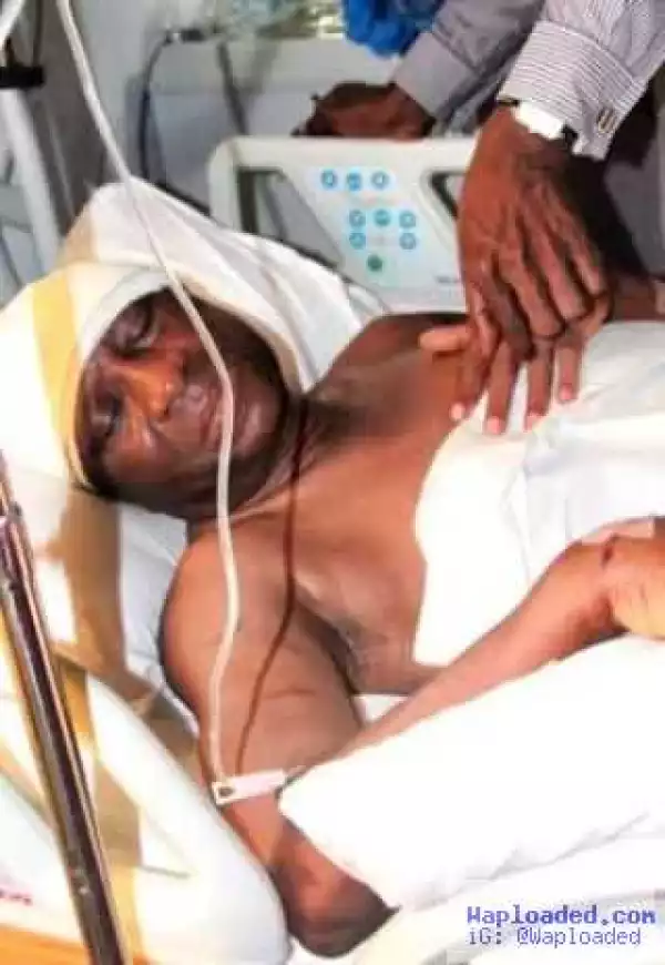 Photo: Younger brother of Bayelsa State Deputy Governor attacked by hoodlums
